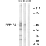 Western Blot - Anti-PPP4R2 Antibody (C18662) - Antibodies.com