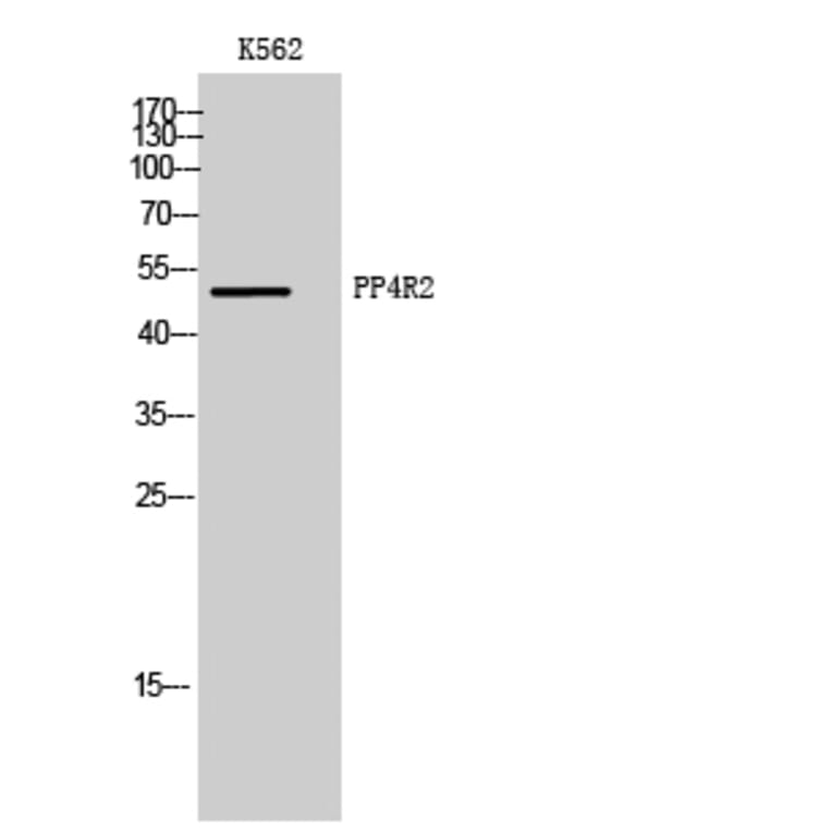 Western Blot - Anti-PPP4R2 Antibody (C18662) - Antibodies.com