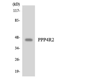 Western Blot - Anti-PPP4R2 Antibody (R12-3359) - Antibodies.com