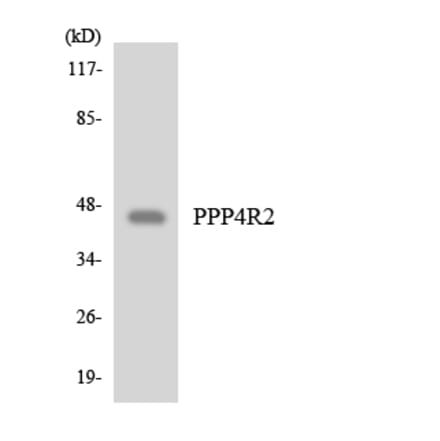 Western Blot - Anti-PPP4R2 Antibody (R12-3359) - Antibodies.com