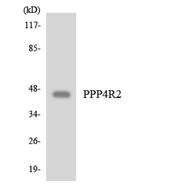 Western Blot - Anti-PPP4R2 Antibody (R12-3359) - Antibodies.com