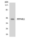 Western Blot - Anti-PPP4R2 Antibody (R12-3359) - Antibodies.com