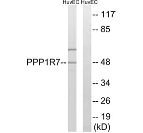 Western Blot - Anti-PPP1R7 Antibody (C18018) - Antibodies.com