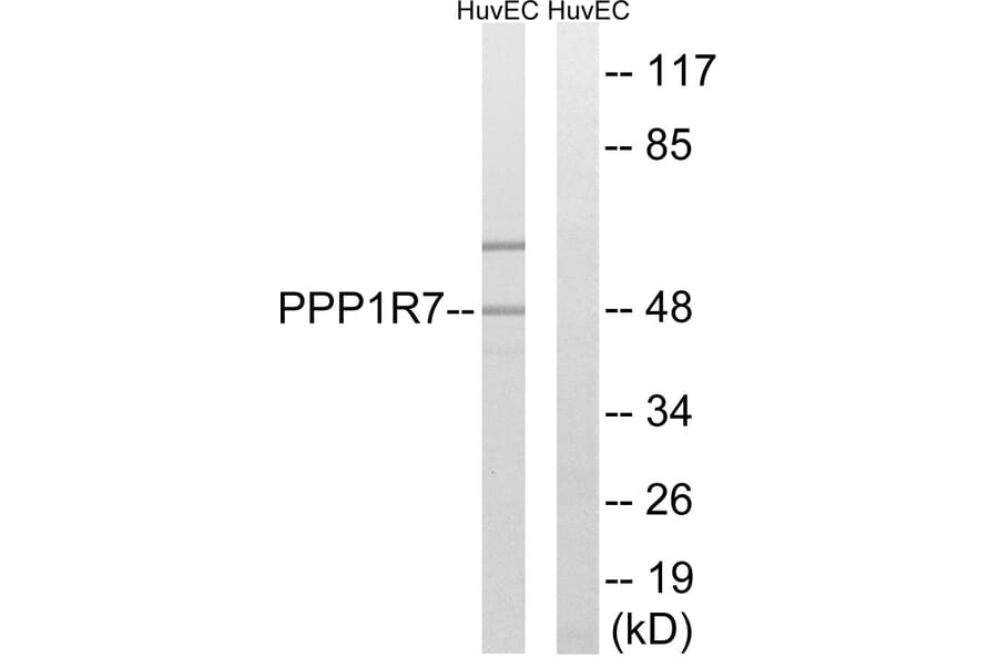 Western Blot - Anti-PPP1R7 Antibody (C18018) - Antibodies.com
