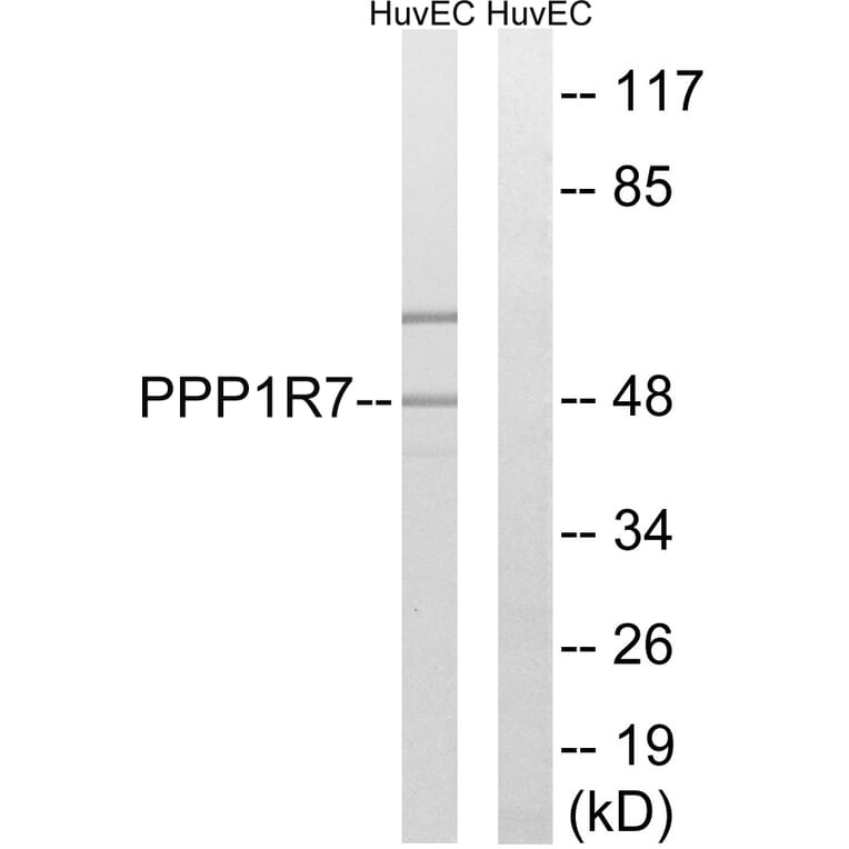 Western Blot - Anti-PPP1R7 Antibody (C18018) - Antibodies.com