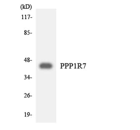 Western Blot - Anti-PPP1R7 Antibody (R12-3351) - Antibodies.com