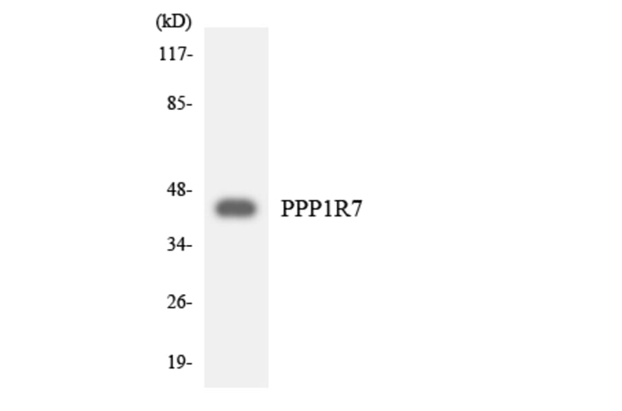 Western Blot - Anti-PPP1R7 Antibody (R12-3351) - Antibodies.com