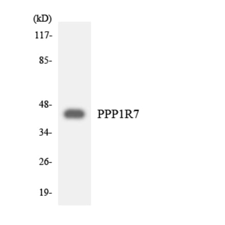 Western Blot - Anti-PPP1R7 Antibody (R12-3351) - Antibodies.com