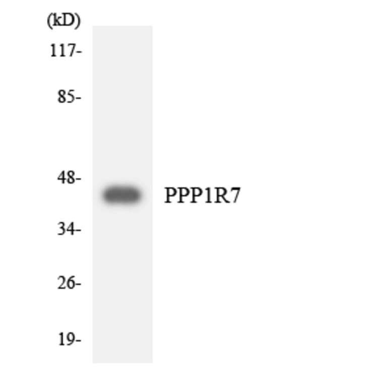 Western Blot - Anti-PPP1R7 Antibody (R12-3351) - Antibodies.com