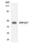 Western Blot - Anti-PPP1R7 Antibody (R12-3351) - Antibodies.com