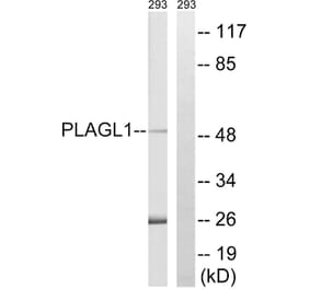 Western Blot - Anti-PLAGL1 Antibody (C20728) - Antibodies.com