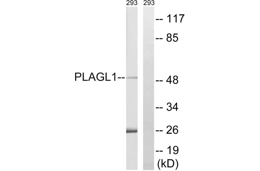 Western Blot - Anti-PLAGL1 Antibody (C20728) - Antibodies.com