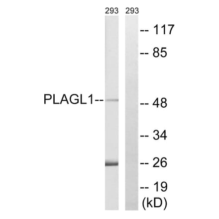 Western Blot - Anti-PLAGL1 Antibody (C20728) - Antibodies.com