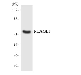 Western Blot - Anti-PLAGL1 Antibody (R12-3334) - Antibodies.com