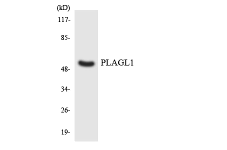 Western Blot - Anti-PLAGL1 Antibody (R12-3334) - Antibodies.com