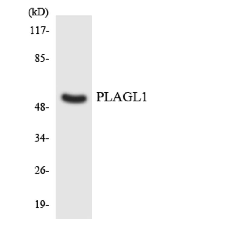 Western Blot - Anti-PLAGL1 Antibody (R12-3334) - Antibodies.com