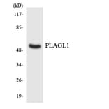 Western Blot - Anti-PLAGL1 Antibody (R12-3334) - Antibodies.com