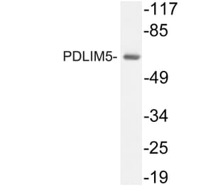 Western Blot - Anti-PDLIM5 Antibody (R12-2298) - Antibodies.com