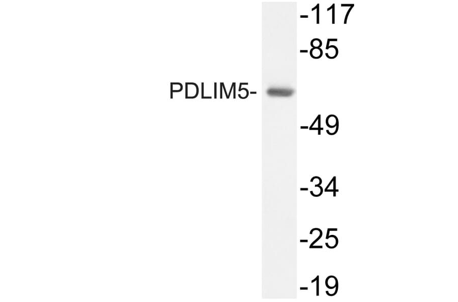 Western Blot - Anti-PDLIM5 Antibody (R12-2298) - Antibodies.com