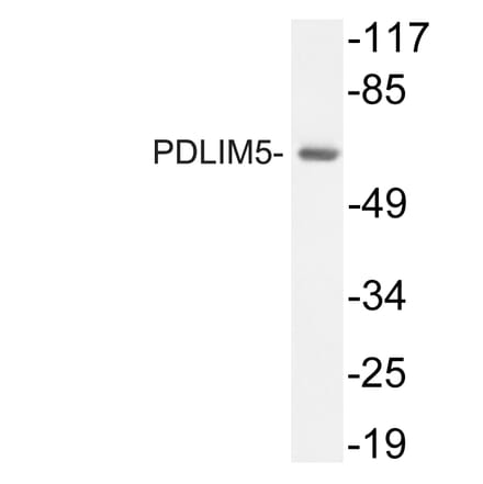 Western Blot - Anti-PDLIM5 Antibody (R12-2298) - Antibodies.com