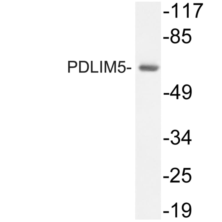 Western Blot - Anti-PDLIM5 Antibody (R12-2298) - Antibodies.com