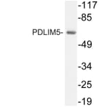 Western Blot - Anti-PDLIM5 Antibody (R12-2298) - Antibodies.com