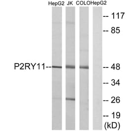 Western Blot - Anti-P2RY11 Antibody (G714) - Antibodies.com
