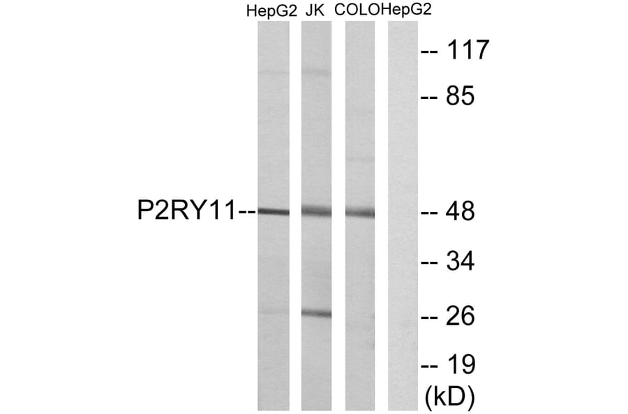 Western Blot - Anti-P2RY11 Antibody (G714) - Antibodies.com