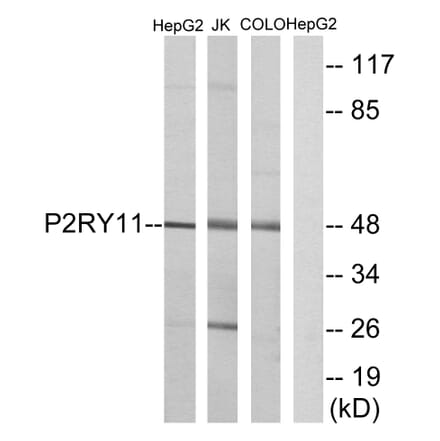 Western Blot - Anti-P2RY11 Antibody (G714) - Antibodies.com
