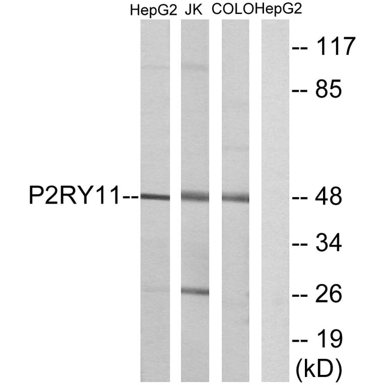 Western Blot - Anti-P2RY11 Antibody (G714) - Antibodies.com