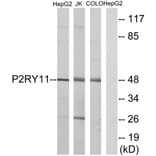 Western Blot - Anti-P2RY11 Antibody (G714) - Antibodies.com