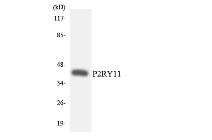 Western Blot - Anti-P2RY11 Antibody (R12-3280) - Antibodies.com