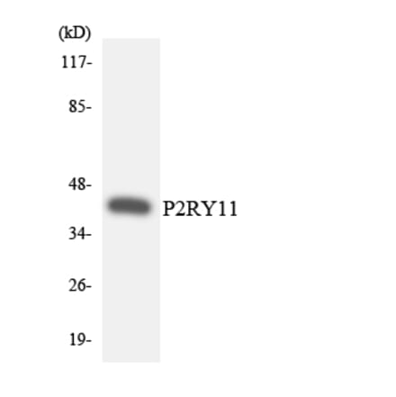 Western Blot - Anti-P2RY11 Antibody (R12-3280) - Antibodies.com