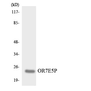 Western blot analysis of the lysates from COLO205 cells using Anti-OR7E5P Antibody.