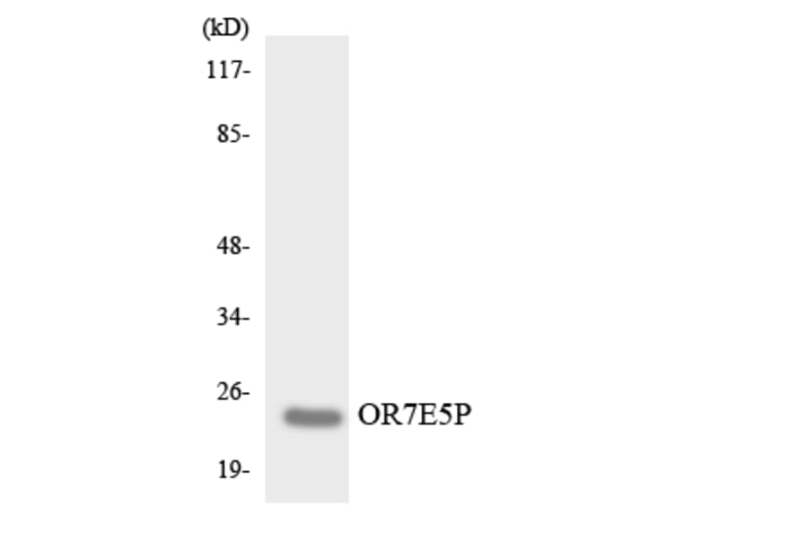 Western Blot - Anti-OR7E5P Antibody (R12-3261) - Antibodies.com