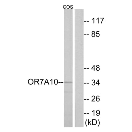 Western Blot - Anti-OR7A10 Antibody (G675) - Antibodies.com