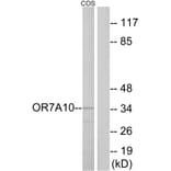 Western Blot - Anti-OR7A10 Antibody (G675) - Antibodies.com