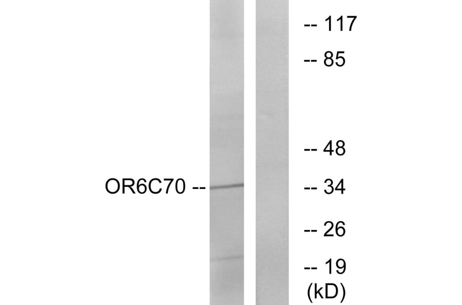 Western Blot - Anti-OR6C70 Antibody (G481) - Antibodies.com