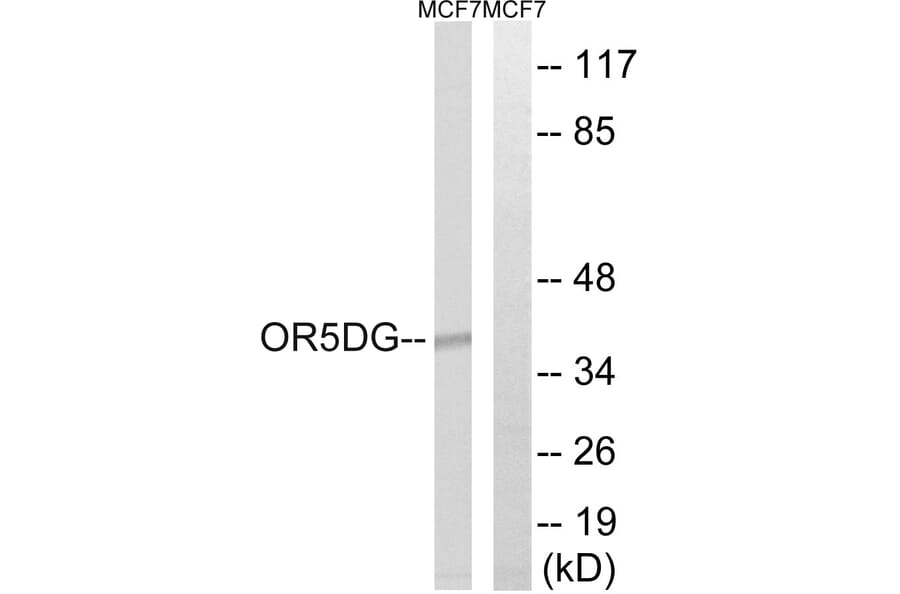 Western Blot - Anti-OR5D16 Antibody (G910) - Antibodies.com