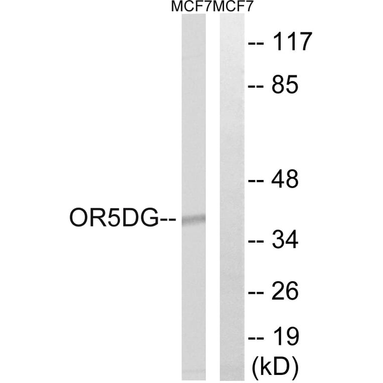Western Blot - Anti-OR5D16 Antibody (G910) - Antibodies.com