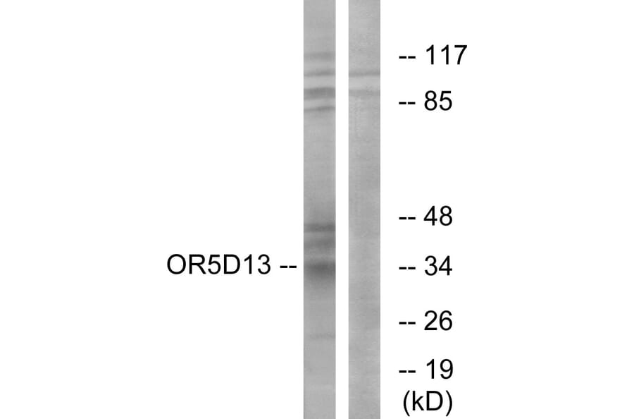 Western Blot - Anti-OR5D13 Antibody (G633) - Antibodies.com