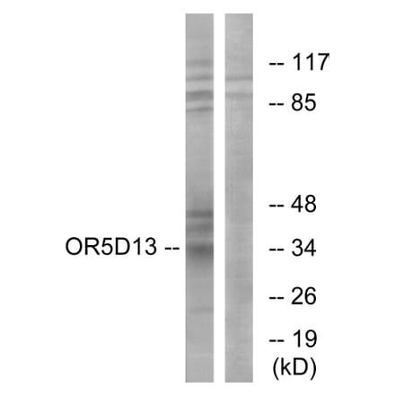 Western Blot - Anti-OR5D13 Antibody (G633) - Antibodies.com