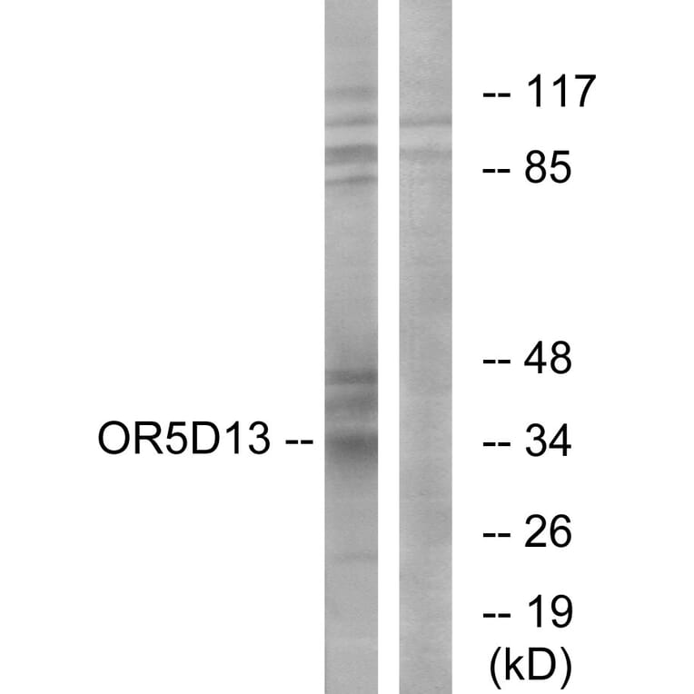 Western Blot - Anti-OR5D13 Antibody (G633) - Antibodies.com