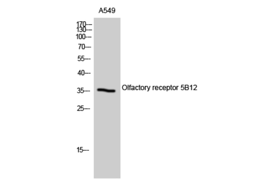Western Blot - Anti-OR5B12 Antibody (G626) - Antibodies.com