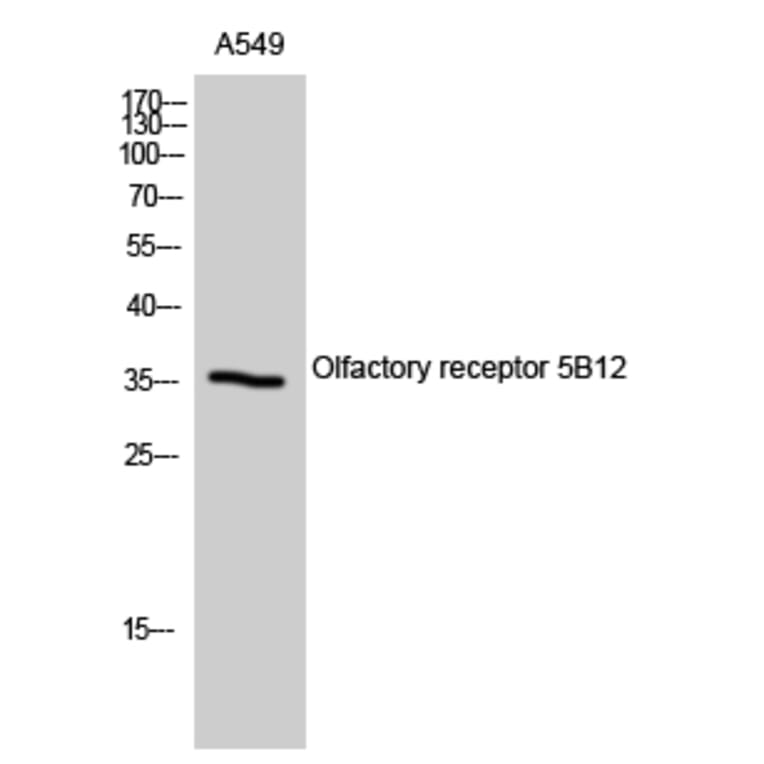 Western Blot - Anti-OR5B12 Antibody (G626) - Antibodies.com