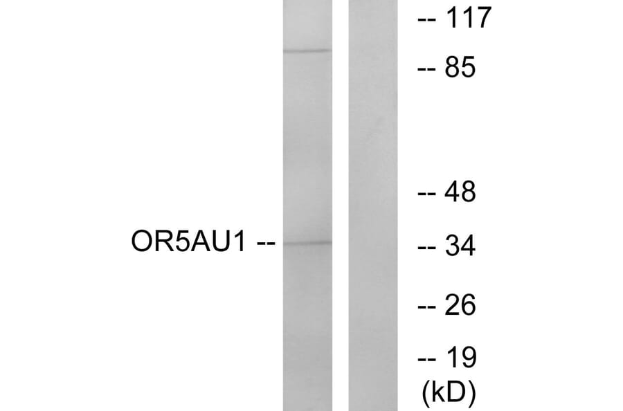 Western Blot - Anti-OR5AU1 Antibody (G476) - Antibodies.com