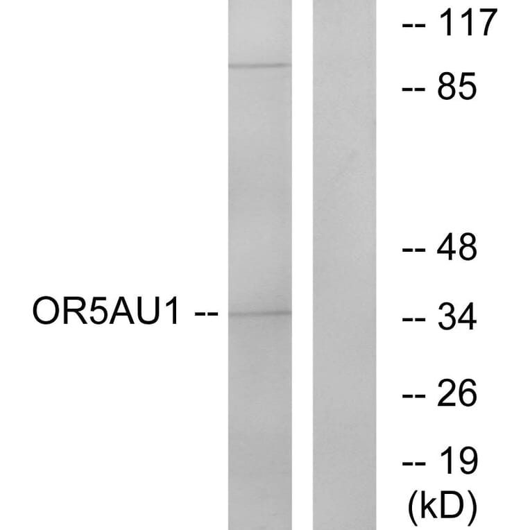 Western Blot - Anti-OR5AU1 Antibody (G476) - Antibodies.com