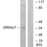 Western Blot - Anti-OR5AU1 Antibody (G476) - Antibodies.com