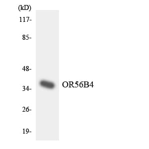 Western blot analysis of the lysates from HT 29 cells using Anti-OR56B4 Antibody.