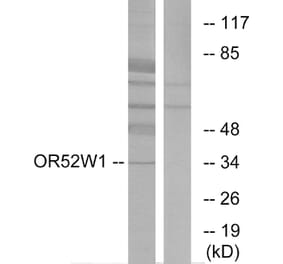 Western Blot - Anti-OR52W1 Antibody (G466) - Antibodies.com